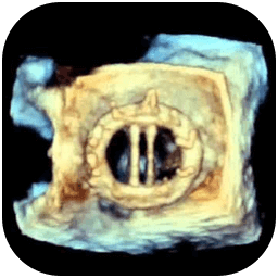 /CURSO%201%20-%20ECO%20TRANSESOFÁGICO%20TRIDIMENSIONAL