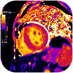 /CURSO%206%20-%20CARDIO-RESONANCIA%20MAGNÉTICA